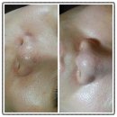 부이656 | 창동피부관리 / 창동피부관리실 로즈마리에스테틱에 다녀온후기