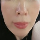 림의 집 | 코페르 멜라크림 야노시호 기미크림 모공 한 달차 관리 후기