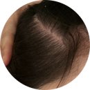 서울피부비만센터 스킨앤슬림 | [북가좌동 피부관리] 바디슬리밍 효과 가득한 미톡스로 얼굴 바디 둘다 챙기기! "루다스킨앤바디"