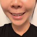 송파 오버립 자연스러운 잠실 립라인 입술 반영구 아리스트 후기