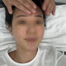 영통역 에스테틱, 정원장의 모공세척테라피에서 고가라인 코나피딜로 피부케어하기 ~