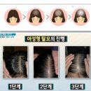 아이리스가발 파주점