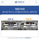 매디플란트 치과의원 | 덕양구치과 불가능한 케이스도, 매디플란트치과에서는 성공적으로!