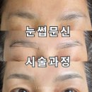 역삼-1290 | 강남 눈썹문신 가격, 시술 과정 및 잘하는 곳 추천