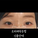 소피레