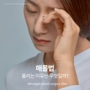 신세계성형외과의원 | 센텀성형외과, 매몰법이 풀리는 이유는 무엇일까?