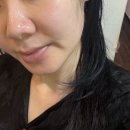 대광빌딩 | 철산동 윤곽관리 추천 수뷰티센터 광명점 얼굴 V라인 되찾은 탄력 리프팅 솔직후기