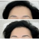 김미화미용실 - 고양시 일산서구 고양대로 706-25 | [내돈내산] 삼송역에서 엄마랑 같이 눈썹문신 받고 일주일 경과 후기 (+탈각,연해짐)