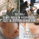 임신하니 얼굴이 왜이렇게 뒤집어지나요? (임신 중 피부관리/피부과 시술)