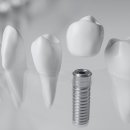 울산스마트치과의원 이미지