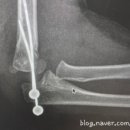 이강연유외과의원 | 소아정형외과 진료 가능 병원 정리(수도권,서울/경기)