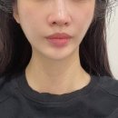 유포리아 에스테틱 이미지