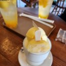 로드성형외과의원 | 눈꺼풀 처짐과 이마 주름이 고민입니다(SB+실리프팅으로 개선) 해운대성형외과