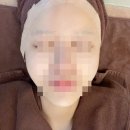 청담동 피부관리 로렐의원 티타늄리프팅 솔직후기