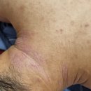 명심한의원 | 부산아토피한의원? 치료가 어렵다는 말만 지겹도록 들어오신 분께 드리는 편지.