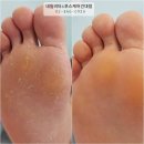 네일비타&푸스케어(건대점) | 건대발각질 네일비타&amp;푸스케어 건대점 후기