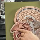 5538 | 부비동염 수술 후기(3) 코 물혹 제거 2주차 코세척 재발