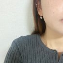 케이트의원 | 홍대 인모드 받고 온 후기 :: 케이트 의원