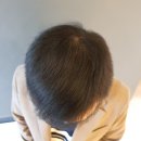 위너뷰티 두피숱채움 후기: 휑한 두피 고민, 이제 안녕!