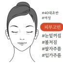 300 | 볼뉴머 300샷 후기 통증 효과 지속기간까지 리얼 리뷰
