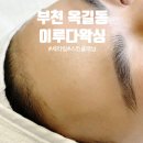 이루다 솔루션 | [부천 왁싱] 이루다왁싱 | 새학기 청소년 세라링(스킨플래닝) 후기