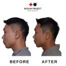 리게인프로젝트 일산 이미지