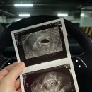 의왕시 보건소 | 의왕시 보건소 임신등록 산전검사 및 임당 검사 후기, 경기도 임산부 혜택