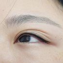 뷰티앤라인 | 뷰티앤라인에서 예뻐진 후기!!~~