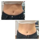 4734 | 광주 신부관리 마사지샵 애끌로 광주점 복부관리 1회 리얼후기