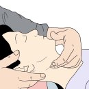 24년 12월 [ FI2 신경가동술과 신경혈관근막 이완요법 ] 세미나 안내 이미지