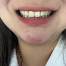 웰컴치과기공소 이미지