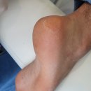 푸스케어청라점 | 인천 청라 발관리 청라 발각질 커플관리 후기(외국인 남친분 쏘스윗)