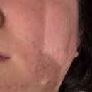 안청남로-1 | 진해여드름관리 혜리온에스테틱 후기