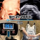 주)찬해영암마트 | 임신 21-28주 증상기록, 이슈는 배땡김 빈혈 체중조절, 입초 네번만에 성공
