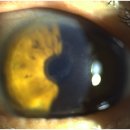 서울맑은눈안과의원 이미지