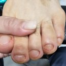 송도발톱 잘 보는 곳 발톱전문 남자다움 이용 후기