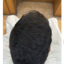 남자 정수리 ‘뻥’ 뚫렸다면 지금 심각합니다 하지만… 르네시떼미용실 부산사상점이면 ‘1회차에 반전’ 납니다** / 중구서구동구영도구부산 이미지