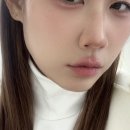 예쁜브이라인의원 | 민트실리프팅 2주차 리얼 후기: 비대칭·마리오네트 라인 개선된 변화 기록