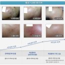 비비한의원 이미지