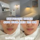 971 | 중랑구피부관리 아이올라 상봉동 피부결·속건조 개선 케어
