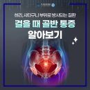 검단사거리역정형외과, 골반 통증과 고관절 질환 구분하기 이미지