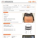 부산 맘모스헤어라인의원 이미지