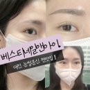 대전우체국 건물 내 | 자연스럽게 잔흔 커버 완벽한 대전눈썹 베스티네일앤아이