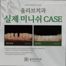 디지털올리브치과의원 이미지