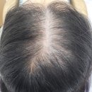 씨유 신촌르메이에르점 | [신촌] 인뷰티: 20대 여자의 탈모 극복기, 탈모커버(두피커버)를 하다