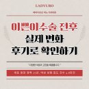 이쁜이옷 | 이쁜이수술 전후 실제 변화 후기로 확인하기