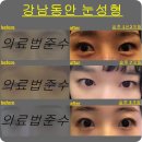 지디에스성형외과