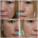 서유에스테틱 | 사직동 에스테틱 맞춤형 피부관리 서유에스테틱 콜라젠 토네이도 물방울리프팅