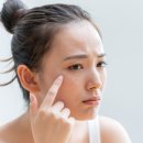 쥐젖 제거 방법 총정리: 자가 치료부터 병원 시술까지 분석