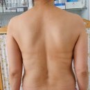 엘림에너지 | 서초피부관리 엘림피부경락 통증에 좋은 상체관리 후기 추천